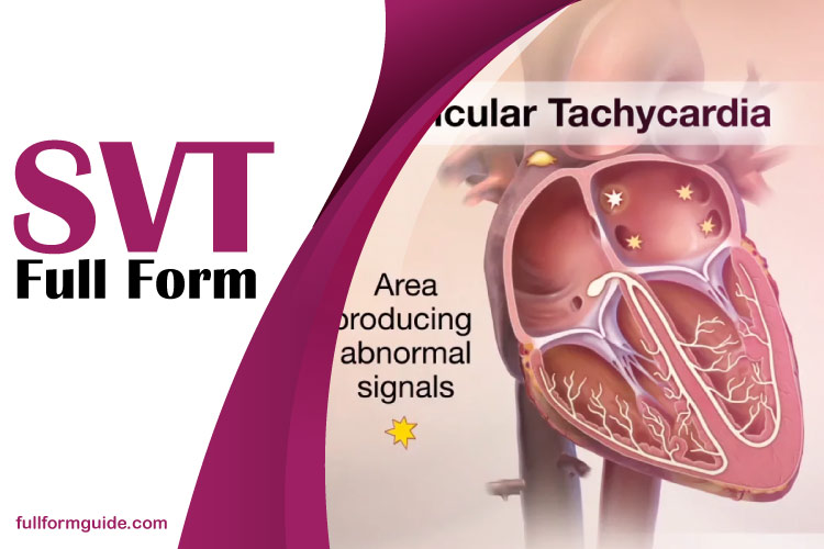 SVT Full Form: Understanding the Complete Form of Medical Term